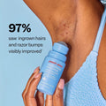 The Body Rescue Trio from Peach Slices - Smoothing Solution Ingrown Hair Treatment, Fix All Recovery Spray, Breakout Banisher Body Lotion